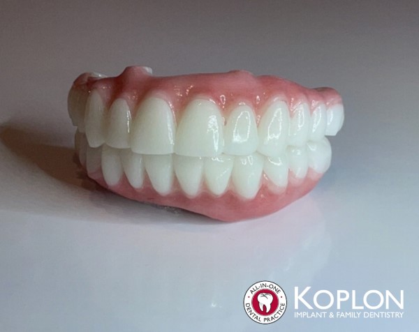 koplon implant - teeth 600x476
